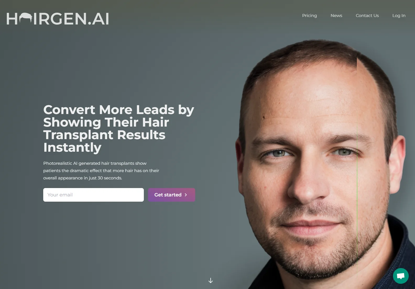 AI-Powered Hair Transplant Previews | Hairgen.ai